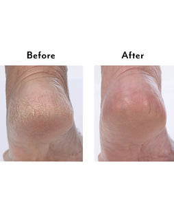 Thera Intensive Foot Cream